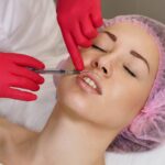 medicina estetica ritocco filler 123rf free